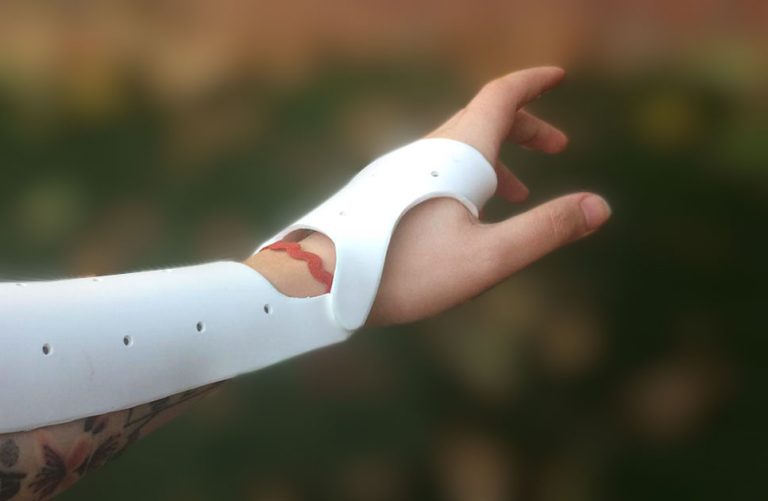 Terapia Ocupacional adapta las experiencias prácticas al formato virtual: estudiantes confeccionan órtesis desde sus hogares